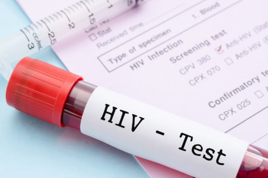 diagnosticati cu HIV
