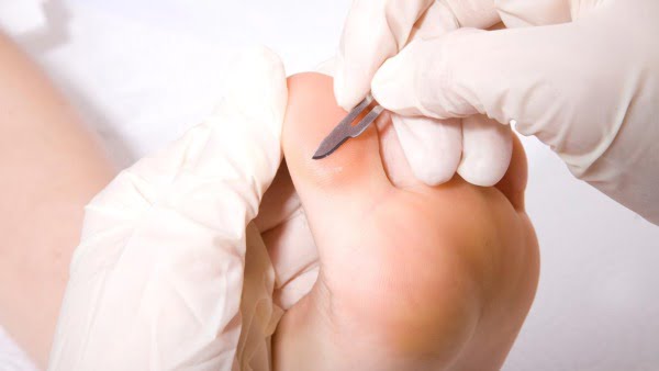 podiatru