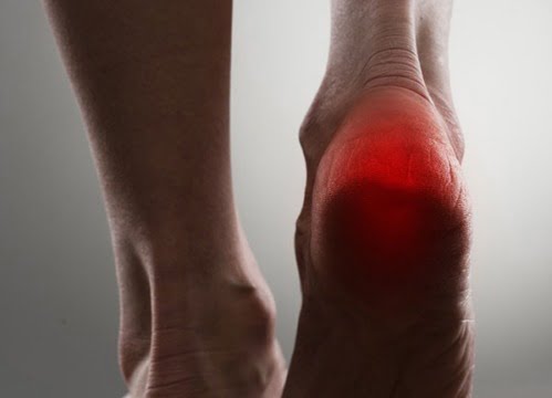 Fasceita plantară