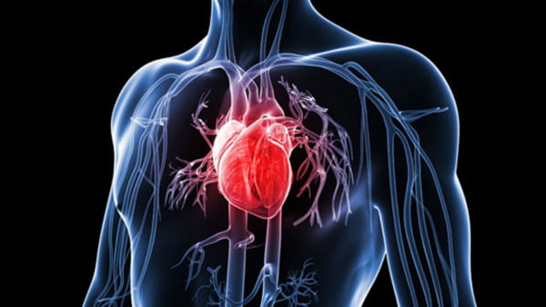 bolile cardiovasculare ucid