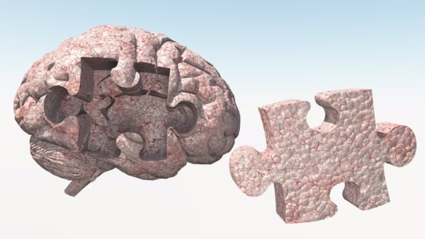 deficit cognitiv Tulburarea cognitivă