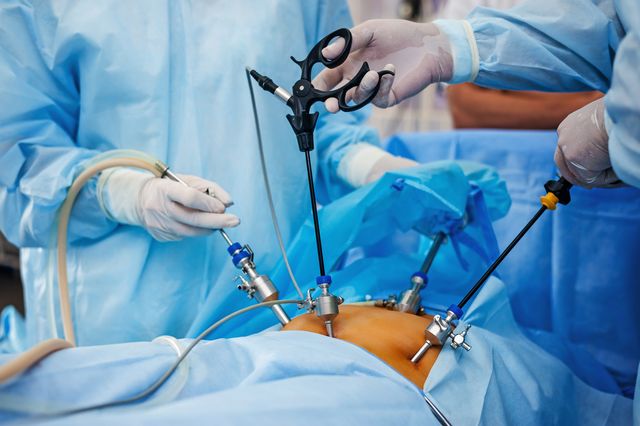 hernia