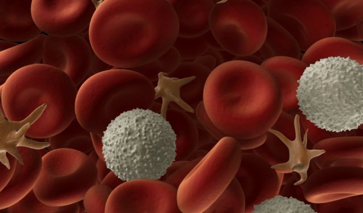 anemia hemolitica