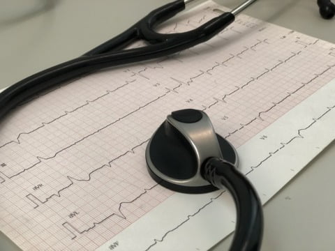EKG nou