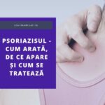 Psoriazisul - cum arată, de ce apare și cum se tratează