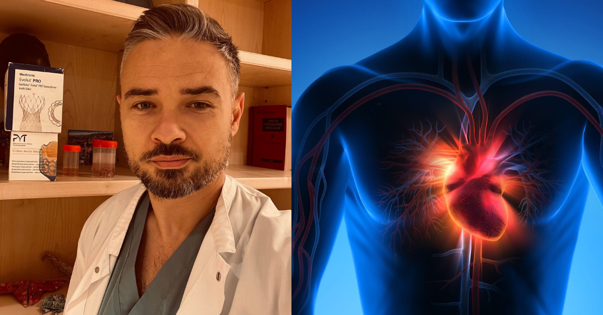 infarctul miocardic acut