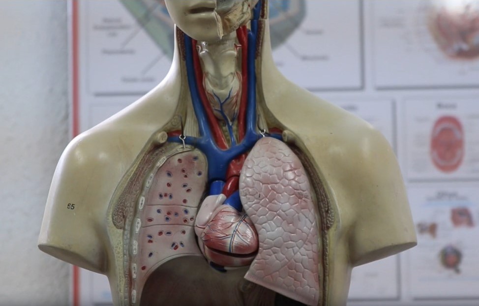 Stenoza arterelor subclavii reprezentata pe un manechin